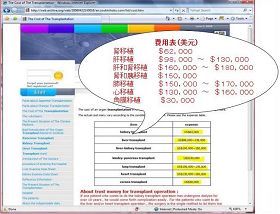 中國醫科大學第一附屬醫院的國際移植（中國）網絡支援中心的費用表(該網站已關閉，截圖來自國際互聯網檔案中心備份https://web.archive.org/web/20060422143018/en.zoukiishoku.com/list/cost.htm)